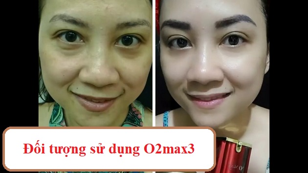 Những người có làn da khô, da bị lão hóa có thể dụng Serum O2max3