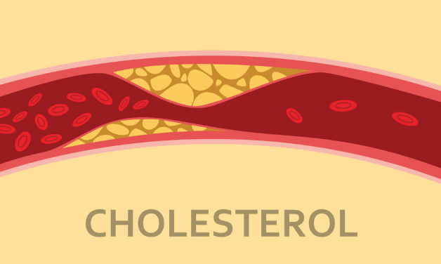 Tác hại của cholesterol trong máu cao