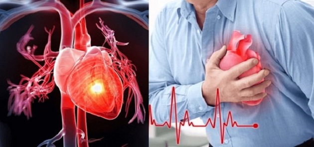 Những nguyên nhân dẫn đến bệnh tim mạch