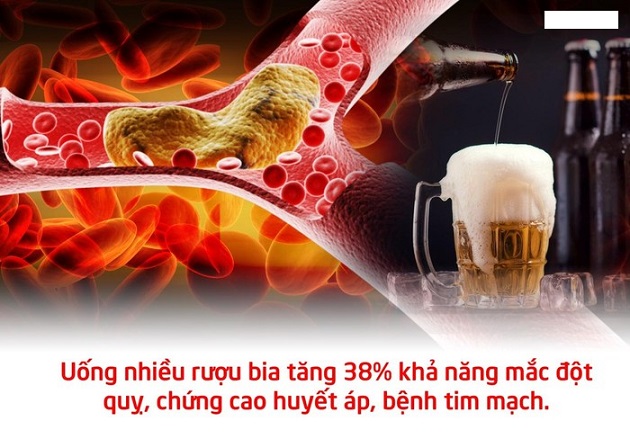 Uống nhiều bia rượu dẫn đến bệnh tim mạch